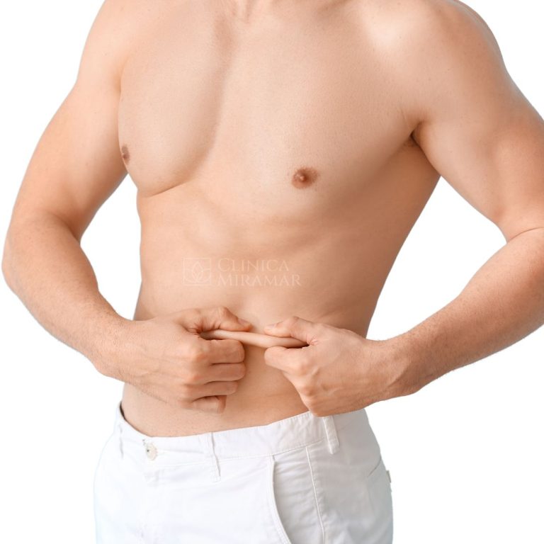 Endolift corporal para eliminación de grasa localizada y remodelación del cuerpo en hombres. Tratamiento disponible en Benissa, Calpe, Moraira, Altea, Jávea y Teulada.