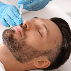 Labios naturales y definidos tras tratamiento con ácido hialurónico en Clínica Miramar, Benissa Moraira